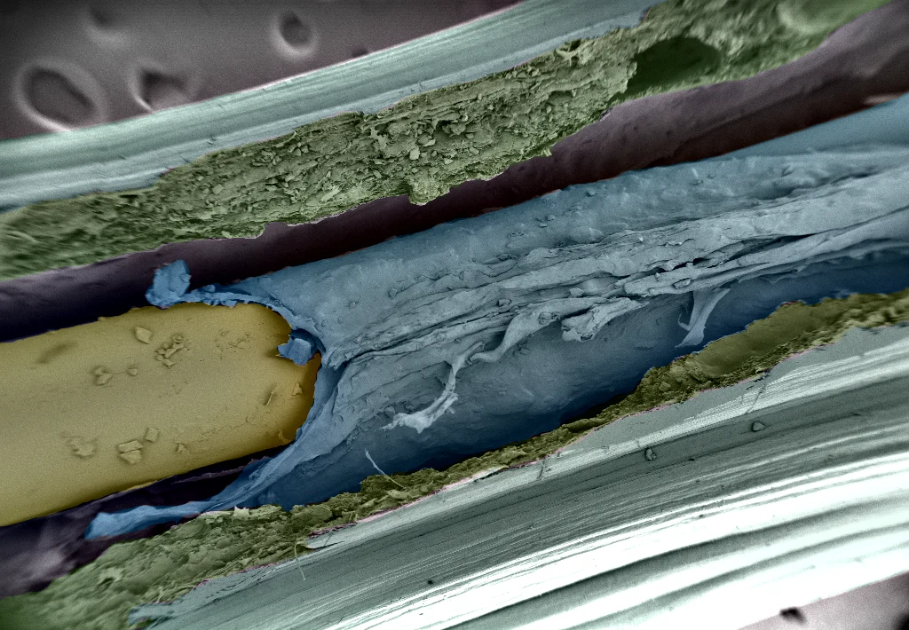 Layered bioFiber structure